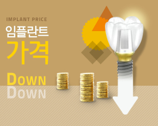 임플란트가격DOWN