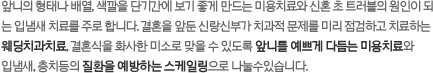 앞니의 형태나 배열, 색깔을 단기간에 보기 좋게 만드는 미용치료와 신혼 초 트러블의 원인이 되는 입냄새 치료를 주로 합니다. 결혼을 앞둔 신랑신부가 치과적 문제를 미리 점검하고 치료하는웨딩치과치료, 결혼식을 화사한 미소로 맞을 수 있도록 앞니를 예쁘게 다듬는 미용치료와 입냄새, 충치등의 질환을 예방하는 스케일링으로 나눌수있습니다. 